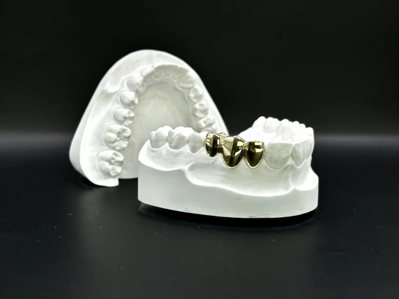 GrillzGermany_Grillz_Gold_Top3_Gold_Grillz_03