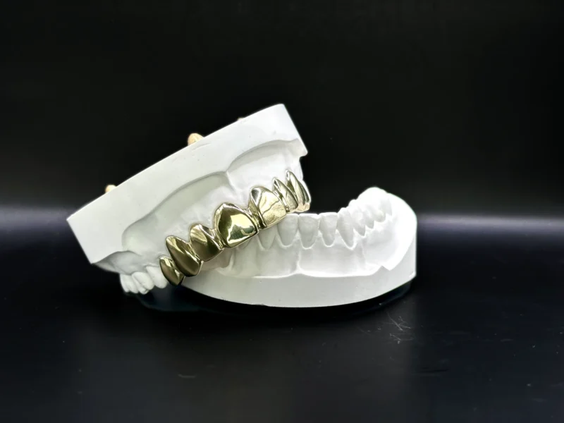 GrillzGermany_Grillz_Gold_Top_8_Gold_02