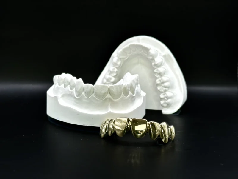 GrillzGermany_Grillz_Gold_Top_8_Gold_05