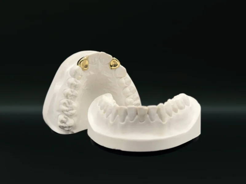 GrillzGermany_Grillz_Gold_Double_Cap_Gold_Grillz_06