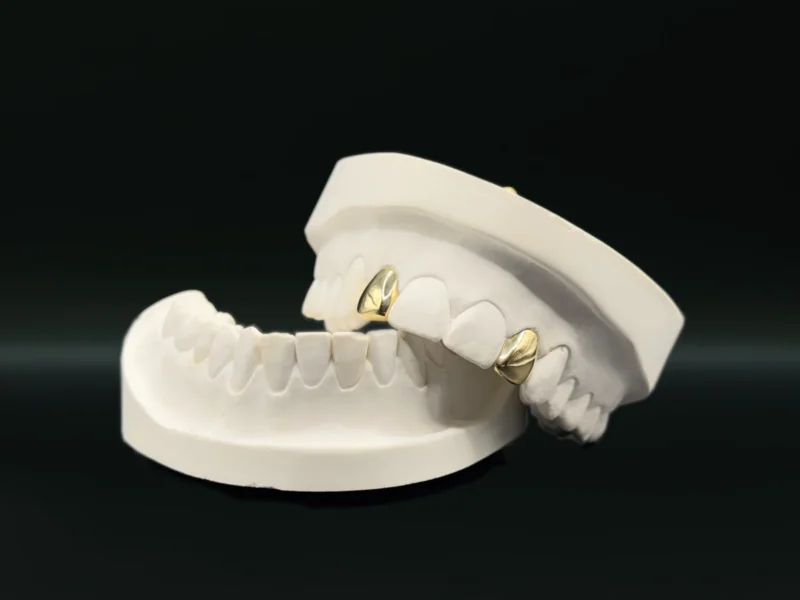 GrillzGermany_Grillz_Gold_Double_Cap_Gold_Grillz_07